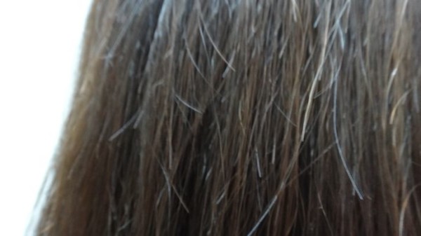 What Causes Hair Breakage