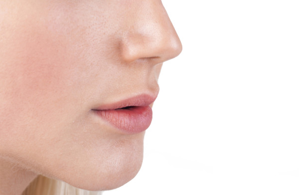 Spider Veins on Nose
