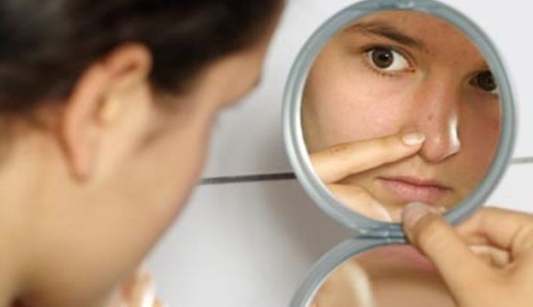 How to Prevent Blackheads on my Nose