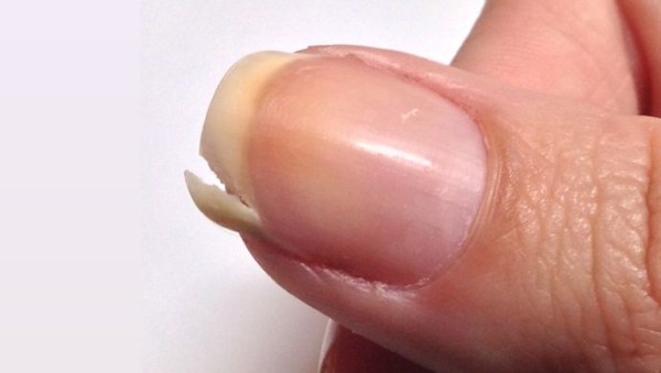 How To Fix A Split Nail