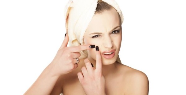 Home Remedies for Acne