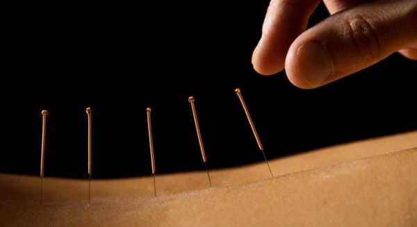 Acupuncture for Fertility